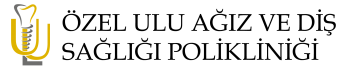 Uludiş